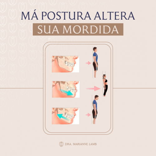 A má postura altera sua mordida